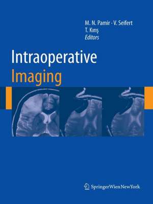 Intraoperative Imaging de M. Necmettin Pamir