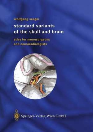 Standard Variants of the Skull and Brain: Atlas for Neurosurgeons and Neuroradiologists de Wolfgang Seeger