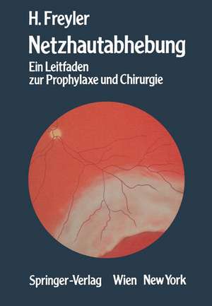 Netzhautabhebung: Ein Leitfaden zur Prophylaxe und Chirurgie de Heinrich Freyler