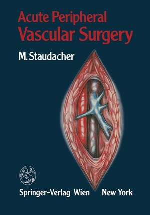 Acute Peripheral Vascular Surgery de Michael Staudacher