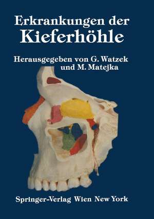 Erkrankungen der Kieferhöhle: Symposium, Fuschl, 26.–29. September 1985 de G. Watzek