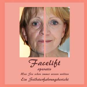 Facelift operativ de Bernhard Siegmund