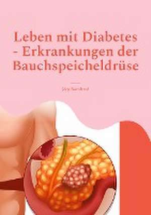 Leben mit Diabetes - Erkrankungen der Bauchspeicheldrüse de Jörg Bernhard