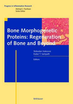 Bone Morphogenetic Proteins: Regeneration of Bone and Beyond de Slobodan Vukicevic