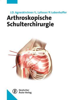 Arthroskopische Schulterchirurgie de Jens Agneskirchner