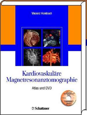 Kardiovaskuläre Magnetresonanztomographie de Vinzenz Hombach