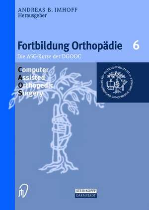 Computer Assisted Orthopedic Surgery de A.B. Imhoff