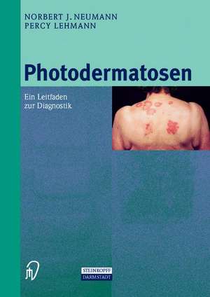 Photodermatosen: Ein Leitfaden zur Diagnostik de N.J. Neumann