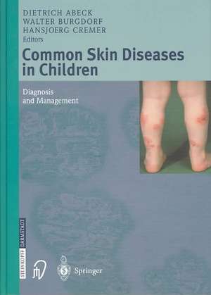 Common Skin Diseases in Children: Diagnosis and Management de Dietrich Abeck