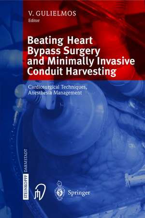 Beating Heart Bypass Surgery and Minimally Invasive Conduit Harvesting: Cardiosurgical Techniques, Anesthesia Management de V. Gulielmos