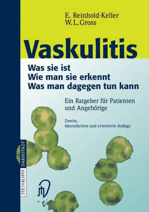 Vaskulitis: Was ist sie - Wie man sie erkennt - Was man dagegen tun kann de Eva Reinhold-Keller