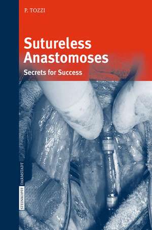 Sutureless Anastomoses: Secrets for Success de Piergiorgio Tozzi