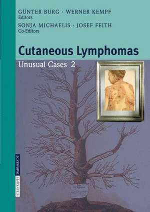 Cutaneous Lymphomas: Unusual Cases 2 de S. Michaelis