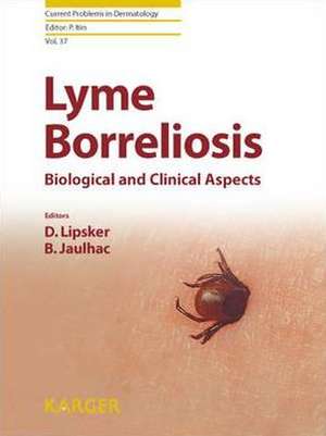 Lyme Borreliosis de D. Lipsker