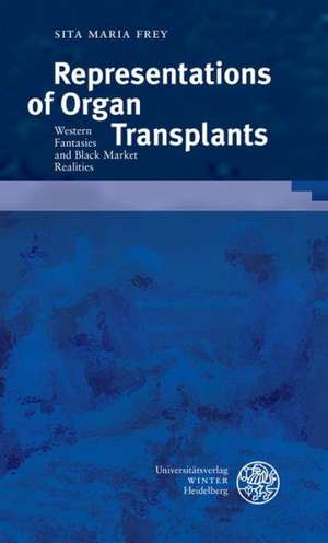 Representations of Organ Transplants de Sita Maria Frey