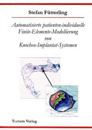 Automatisierte Patienten-Individuelle Finite-Elemente-Modellierung Von Knochen-Implantat-Systemen: Untersuchungen Zum Mimischen Ausdrucksverhalten Und Zur Emotionserkennung de Stefan Fütterling