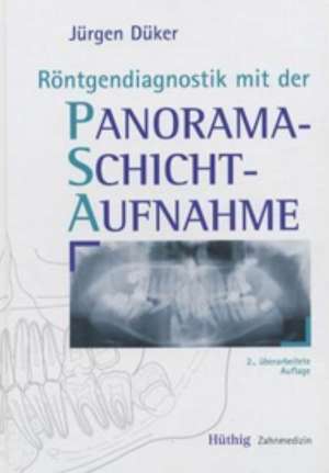 Röntgendiagnostik mit der Panoramaschichtaufnahme de Jürgen Düker