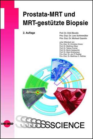 Prostata-MRT und MRT-gestützte Biopsie de Dirk Blondin