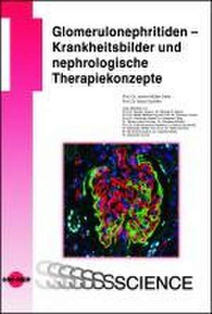 Glomerulonephritiden - Krankheitsbilder und nephrologische Therapiekonzepte de Janina Müller-Deile