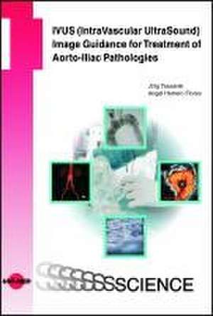 IVUS (IntraVascular UltraSound) Image Guidance for Treatment of Aorto-Iliac Pathologies de Jörg Tessarek