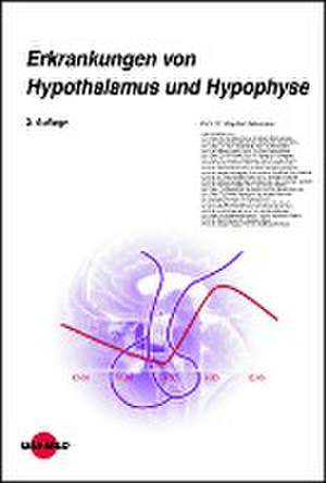 Erkrankungen von Hypothalamus und Hypophyse de Stephan Petersenn