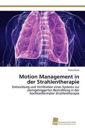 Motion Management in Der Strahlentherapie: Measurement and Source Allocation de Franz Gum