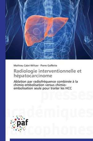 Radiologie interventionnelle et hépatocarcinome de Mathieu Cabri-Wiltzer