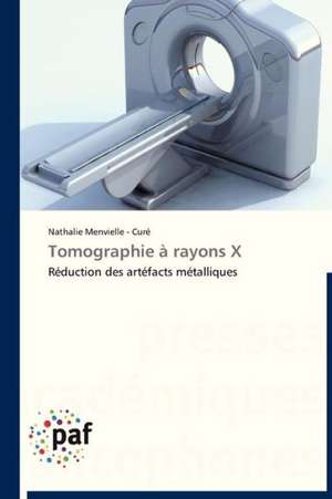 Tomographie à rayons X de Nathalie Menvielle - Curé