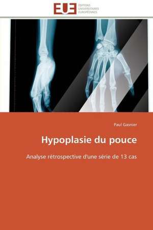 Hypoplasie Du Pouce: Comment Expliciter Les Besoins Des Apprenants? de Paul Gasnier