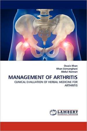 Management of Arthritis de Owais Khan