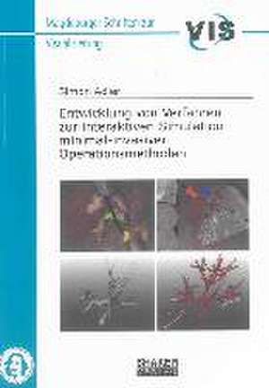 Entwicklung von Verfahren zur interaktiven Simulation minimal-invasiver Operationsmethoden de Simon Adler