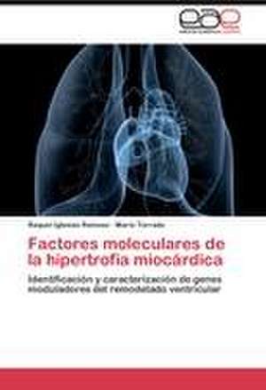 Factores moleculares de la hipertrofia miocárdica de Raquel Iglesias Reinoso