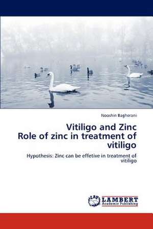 Vitiligo and Zinc Role of zinc in treatment of vitiligo de Nooshin Bagherani