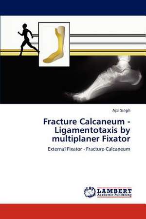 Fracture Calcaneum - Ligamentotaxis by multiplaner Fixator de Ajai Singh