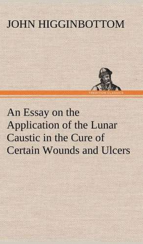 An Essay on the Application of the Lunar Caustic in the Cure of Certain Wounds and Ulcers de John Higginbottom