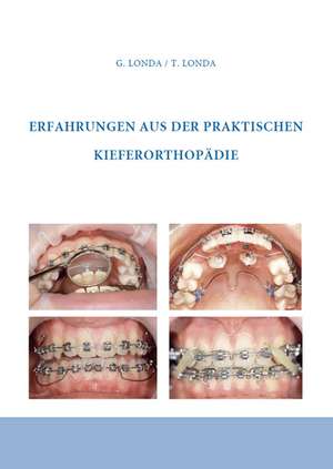 Erfahrungen aus der praktischen Kieferorthopädie de Gennadij Londa