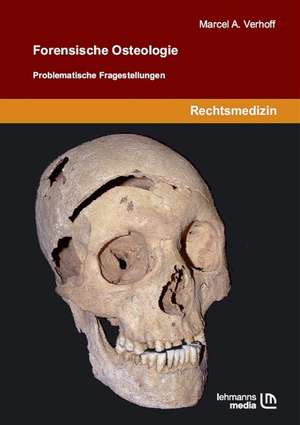 Forensische Osteologie de Marcel A. Verhoff