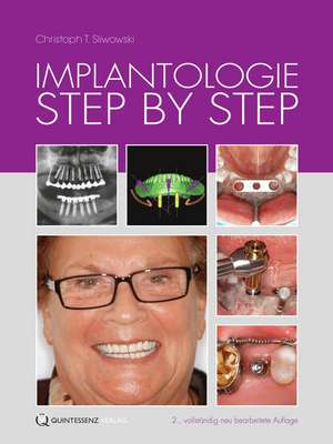 Implantologie Step by Step de Christoph T. Sliwowski