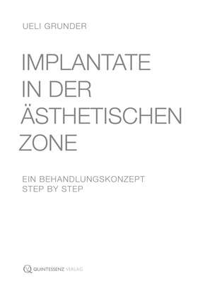 Implantate in der ästhetischen Zone de Ueli Grunder