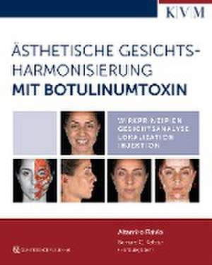 Ästhetische Gesichtsharmonisierung mit Botulinumtoxin de Altamiro Flávio