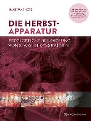 Die Herbst-Apparatur de Hans Pancherz