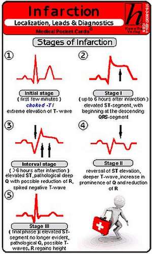 Infarction Localization, Leads & Diagnostics