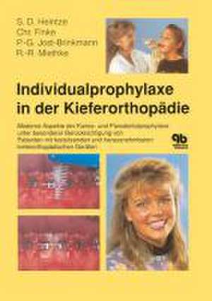 Individualprophylaxe in der Kieferorthopädie