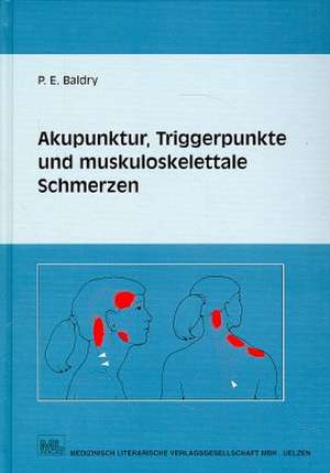 Akupunktur, Triggerpunkte und muskoskelettale Schmerzen de Peter E. Baldry