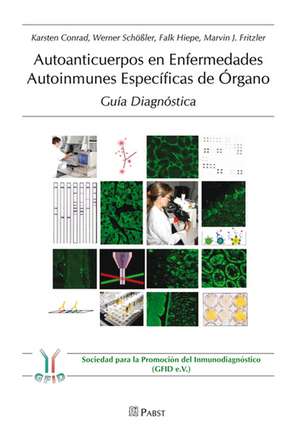 Autoanticuerpos en Enfermedades Autoinmunes Especificas de Organo de Karsten Conrad