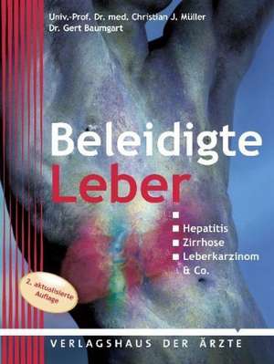 Beleidigte Leber de Christian J. Müller