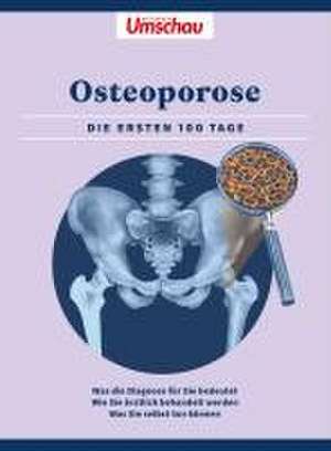 Apotheken Umschau: Osteoporose de Wort & Bild Verlag