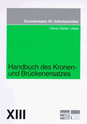 Handbuch des Kronen- und Brückenersatzes de Hans-Dieter Uebe