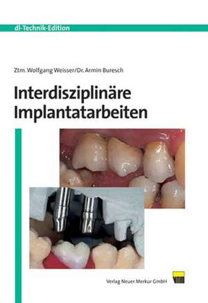 Interdisziplinäre Implantatarbeiten de Wolfgang Weisser