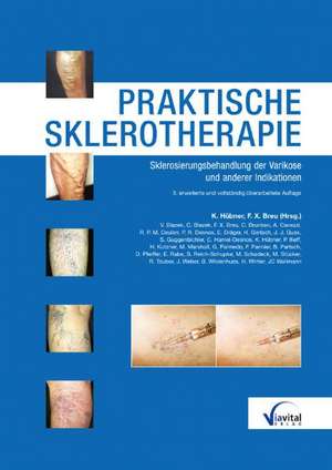 Praktische Sklerotherapie de Klaus Hübner